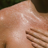 Close-up of a person's shoulder with a hand gently touching it, showing skin texture.